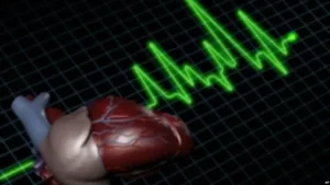 Penyakit Jantung dan Stroke: Pembunuh Terdepan di Amerika