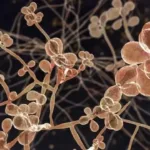 Sporothrix brasiliensis – Jamur Kucing Berbahaya Kini Ancam Uruguay