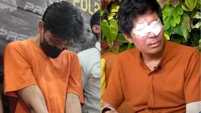 Andrie Yunus: Bola Mata Bocor Pasca Teror Air Keras Andrie Yunus: Bola Mata Bocor Pasca Teror Air Keras