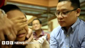 Vaksinasi Campak Turun Drastis Akibat Hoaks Medsos 2026